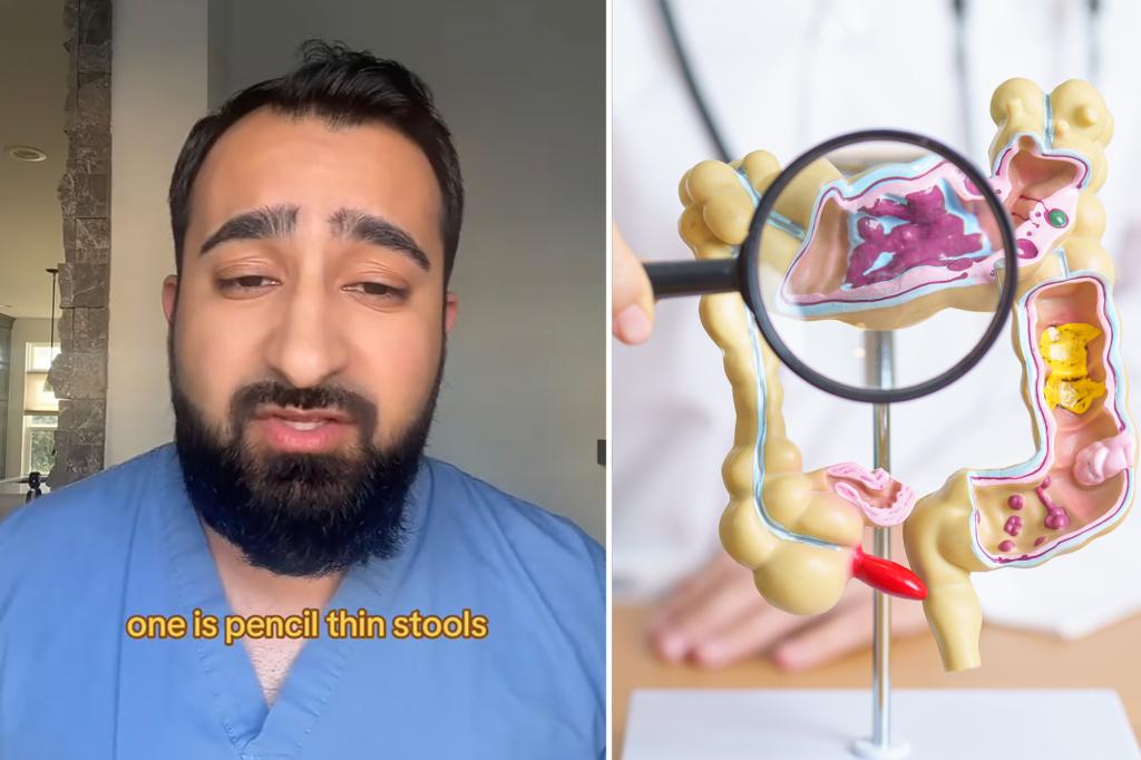 The doctor reveals 5 symptoms that could mean colon cancer