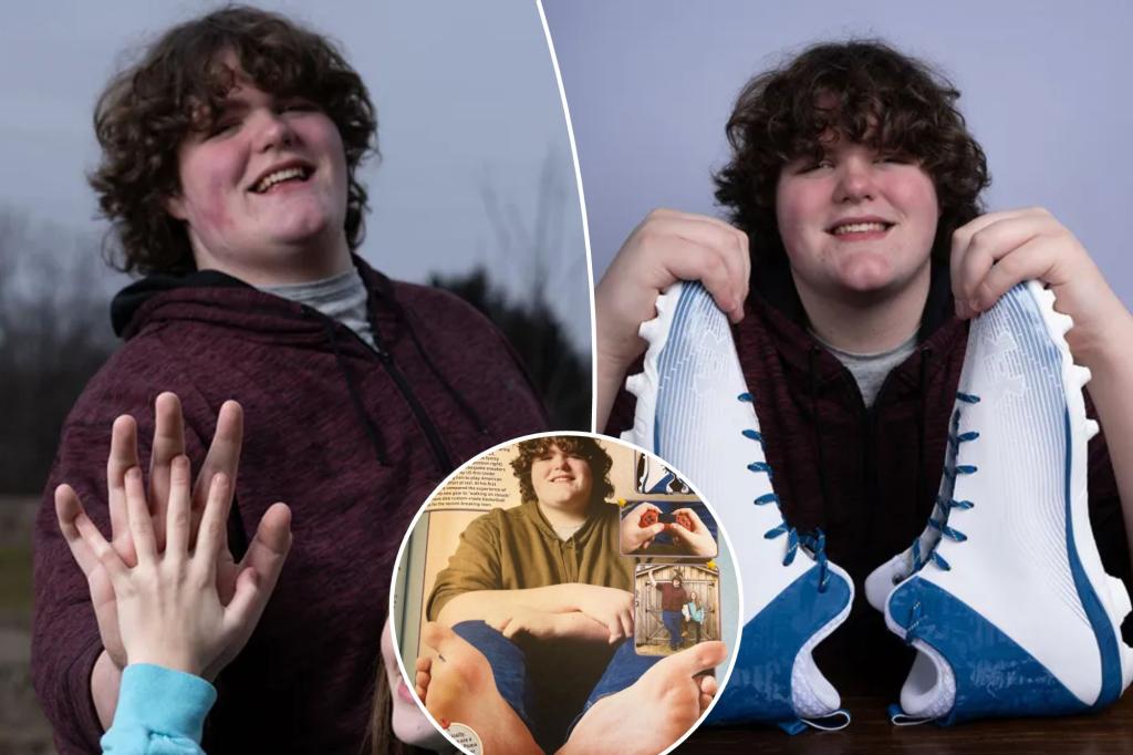 Teen sets world record for biggest feet and hands: 'People are usually surprised'